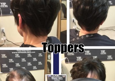 Human hair toppers in Stoney Creek and Burlington