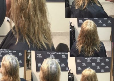 Hair systems in Stoney creek and Burlington
