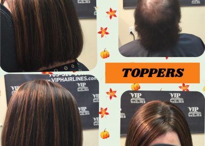 Hair toppers for thinning hair