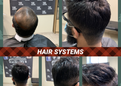 Hair systems for men in Stoney Creek and Burlington